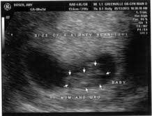 Here's Butterbean 2.0